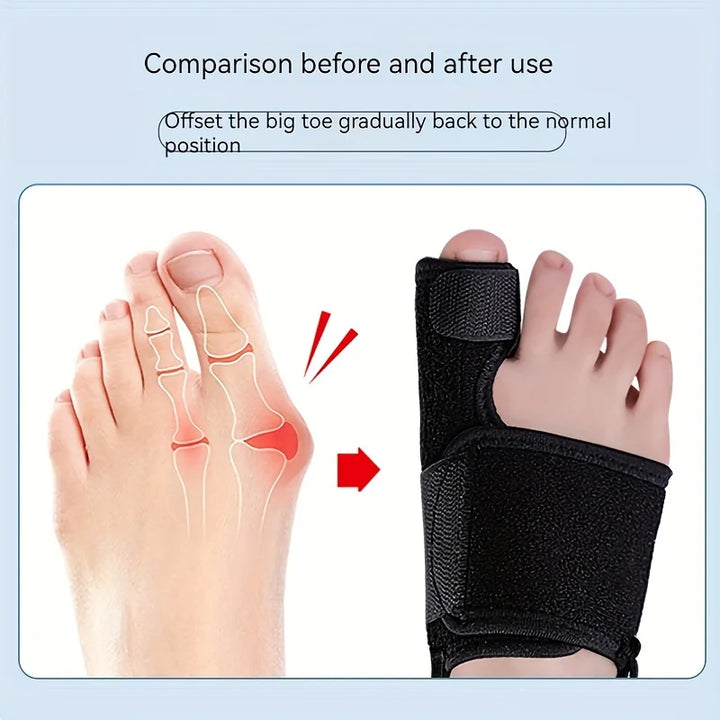 Premium Toe Corrector Orthotics for Hallux Valgus - Adjustable Hammer Toe Protector with Aluminum Strip and Velcro - Soft, 
